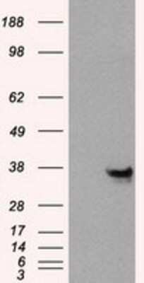 Western Blot: Annexin A10 Antibody (4D8) [NBP2-02282] - HEK293T cells were transfected with the pCMV6-ENTRY control (Left lane) or pCMV6-ENTRY Annexin A10 (Right lane) cDNA for 48 hrs and lysed. Equivalent amounts of cell lysates (5 ug per lane) were separated by SDS-PAGE and immunoblotted with anti-Annexin A10.