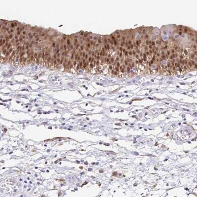 Immunohistochemistry-Paraffin: Annexin A10 Antibody [NBP1-90156] - Staining of human urinary bladder shows moderate nuclear positivity in urothelial cells.