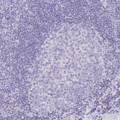 Immunohistochemistry-Paraffin: Annexin A10 Antibody [NBP1-90156] - Staining of human tonsil shows no positivity as expected.