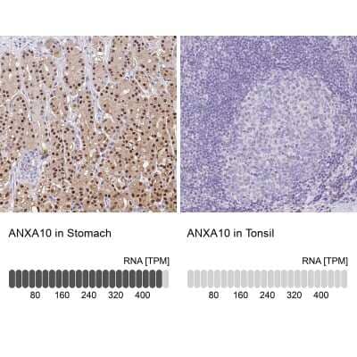Immunohistochemistry-Paraffin: Annexin A10 Antibody [NBP1-90156] - Staining in human stomach and tonsil tissues . Corresponding ANXA10 RNA-seq data are presented for the same tissues.