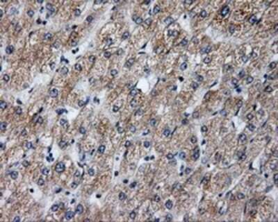 Immunohistochemistry: Annexin A10 Antibody (OTI4D8) - Azide and BSA Free [NBP2-71683] - Staining of paraffin-embedded liver tissue using anti-Annexin A10 mouse monoclonal antibody.