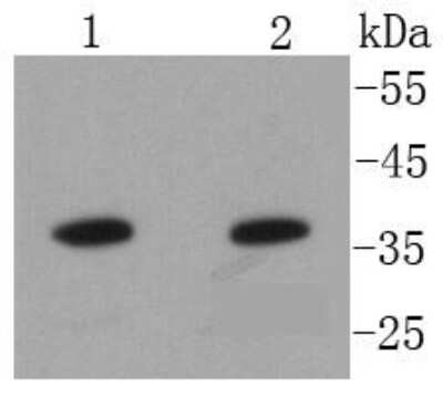 Western Blot: Annexin A10 Antibody (SC06-02) [NBP2-67600] - Analysis of Annexin A10 on different lysates using anti-Annexin A10 antibody at 1/1,000 dilution. Positive control: Lane 1: Hela Lane 2: Jurkat