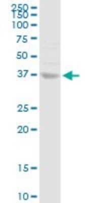 Western Blot: Annexin A10 Antibody [H00011199-D01P] - Analysis of ANXA10 expression in HeLa.