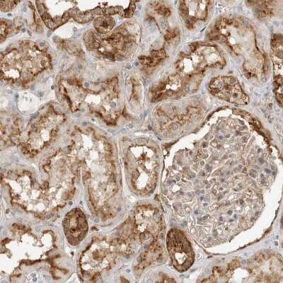 Immunohistochemistry-Paraffin Annexin A11 Antibody