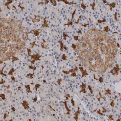 Immunohistochemistry-Paraffin Annexin A11 Antibody