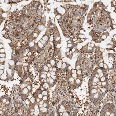 Immunohistochemistry-Paraffin Annexin A11 Antibody