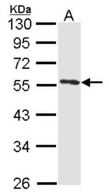 Western Blot: Annexin A11 Antibody [NBP2-15406] - Sample (30 ug of whole cell lysate) A: Hela 10% SDS PAGE Annexin XI antibody, antibody diluted at 1:1000.