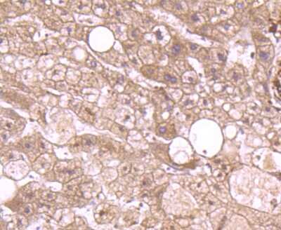 Immunohistochemistry-Paraffin: Annexin A2 Antibody (JA42-30) [NBP2-67155] - Analysis of paraffin-embedded human liver tissue using anti-Annexin A2 antibody. Counter stained with hematoxylin.