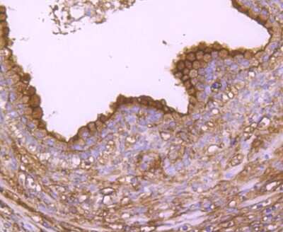 Immunohistochemistry-Paraffin: Annexin A2 Antibody (JA42-30) [NBP2-67155] - Analysis of paraffin-embedded human prostate tissue using anti-Annexin A2 antibody. Counter stained with hematoxylin.