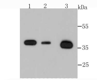 Western Blot: Annexin A2 Antibody (JA42-30) [NBP2-67155] - Analysis of Annexin A2 on different lysates using anti-Annexin A2 antibody at 1/500 dilution. Positive control: Lane 1: Hela Lane 2: Human kidney Lane 3: Murine testis