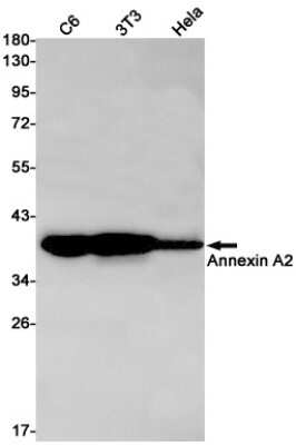 Western Blot: Annexin A2 Antibody (S09-5C1) [NBP3-14907] - Western blot detection of Annexin A2 in C6, 3T3, Hela cell lysates using Annexin A2 Rabbit mAb (1:1000 diluted). Predicted band size: 39kDa. Observed band size: 38kDa.