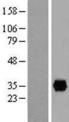 Western Blot: Annexin A2 Overexpression Lysate (Adult Normal) [NBL1-07564] Left-Empty vector transfected control cell lysate (HEK293 cell lysate); Right -Over-expression Lysate for Annexin A2.