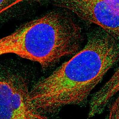 Immunocytochemistry/Immunofluorescence: Annexin A3 Antibody [NBP1-90155] - Immunofluorescent staining of human cell line U-2 OS shows localization to cytosol. Antibody staining is shown in green.