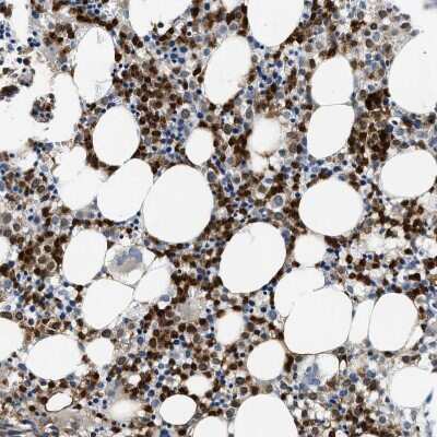 Immunohistochemistry-Paraffin: Annexin A3 Antibody [NBP1-90154] - Staining of human bone marrow shows strong cytoplasmic positivity in hematopoietic cells.