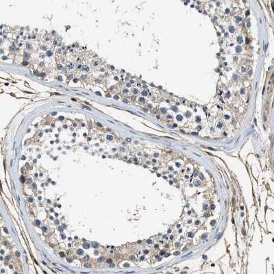 Immunohistochemistry-Paraffin: Annexin A3 Antibody [NBP1-90154] - Staining of human testis shows very weak positivity in cells in seminiferous ducts a expected.