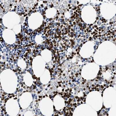 Immunohistochemistry-Paraffin: Annexin A3 Antibody [NBP1-90155] - Staining of human bone marrow shows strong cytoplasmic positivity in hematopoietic cells.