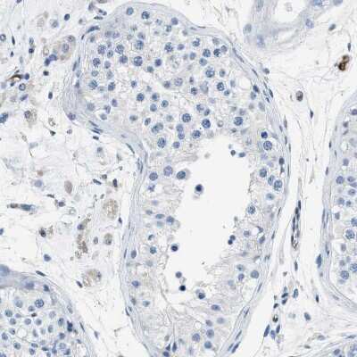 Immunohistochemistry-Paraffin: Annexin A3 Antibody [NBP1-90155] - Staining of human testis shows no positivity in cells in seminiferous ducts as expected.