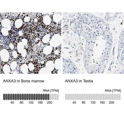 Immunohistochemistry-Paraffin: Annexin A3 Antibody [NBP1-90155] - Analysis in human bone marrow and testis tissues using NBP1-90155 antibody. Corresponding ANXA3 RNA-seq data are presented for the same tissues.