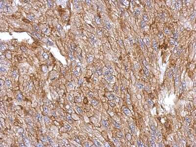 Immunohistochemistry-Paraffin: Annexin A3 Antibody [NBP2-15407] - Paraffin-embedded U87 xenograft, using antibody at 1:500 dilution.