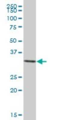 Western Blot: Annexin A3 Antibody [H00000306-B01P] - Analysis of ANXA3 expression in human pancreas.