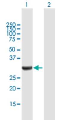 Western Blot: Annexin A3 Antibody [H00000306-B01P] - Analysis of ANXA3 expression in transfected 293T cell line by ANXA3 polyclonal antibody.  Lane 1: ANXA3 transfected lysate(35.53 KDa). Lane 2: Non-transfected lysate.