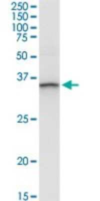 Western Blot: Annexin A3 Antibody [H00000306-D01P] - Analysis of ANXA3 expression in human pancreas.