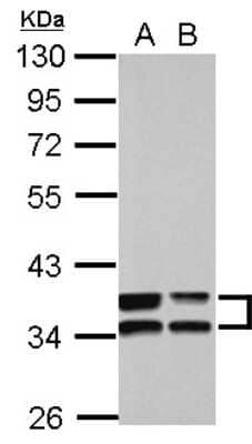 Western Blot: Annexin A3 Antibody [NBP2-15407] - Sample (30 ug of whole cell lysate) A: A549 B: HCT116 10% SDS PAGE; antibody diluted at 1:10000.