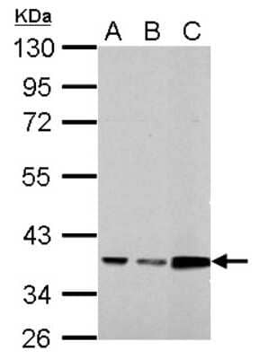 Western Blot: Annexin A3 Antibody [NBP2-15408] - A. 30 ug A431 whole cell lysate/extract, B. 30 ug HeLa whole cell lysate/extract, C. 30 ug A37C whole cell lysate/extract 10 % SDS-PAGE gel, antibody dilution 1:1000.