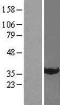 Western Blot: Annexin A3 Overexpression Lysate (Adult Normal) [NBL1-07563] Left-Empty vector transfected control cell lysate (HEK293 cell lysate); Right -Over-expression Lysate for Annexin A3.