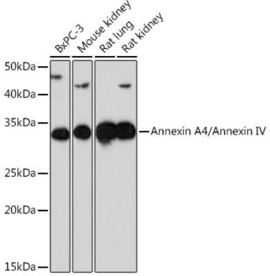 Western Blot: Annexin A4 Antibody (8T6E6) [NBP3-16785] - Western blot analysis of extracts of various cell lines, using Annexin A4/Annexin A4 Rabbit mAb (NBP3-16785) at 1:1000 dilution. Secondary antibody: HRP Goat Anti-Rabbit IgG (H+L) at 1:10000 dilution. Lysates/proteins: 25ug per lane. Blocking buffer: 3% nonfat dry milk in TBST. Detection: ECL Enhanced Kit. Exposure time: 3min.