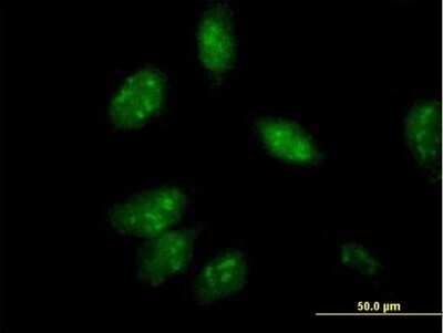 Immunocytochemistry/Immunofluorescence: Annexin A4 Antibody [H00000307-B01P] - Analysis of purified antibody to ANXA4 on HeLa cell. (antibody concentration 10 ug/ml)
