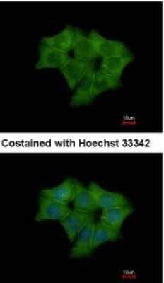 Immunocytochemistry/Immunofluorescence: Annexin A4 Antibody [NBP1-31751] - Analysis of methanol-fixed Hep3B, using antibody at 1:500 dilution.