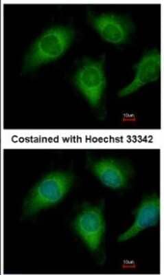 Immunocytochemistry/Immunofluorescence: Annexin A4 Antibody [NBP2-15409] - Analysis of methanol-fixed HeLa, using antibody at 1:200 dilution.