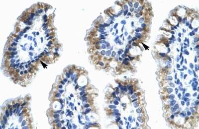 Immunohistochemistry: Annexin A4 Antibody [NBP1-59120] - Human Intestine