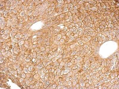 Immunohistochemistry-Paraffin: Annexin A4 Antibody [NBP1-31751] - Paraffin-embedded D54MG xenograft; antibody dilution 1:500.