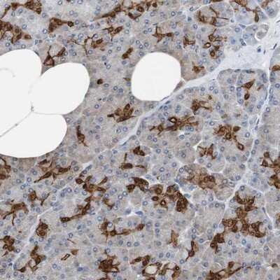 Immunohistochemistry-Paraffin: Annexin A4 Antibody [NBP1-90151] - Staining of human pancreas shows distinct positivity in ductal cells.