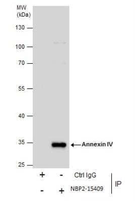 Immunoprecipitation: Annexin A4 Antibody [NBP2-15409] - Immunoprecipitation of Annexin IV protein from HepG2 whole cell extracts using 5 ug of Annexin IV antibody.  Western blot analysis was performed using Annexin IV antibody. EasyBlot anti-Rabbit IgG was used as a secondary reagent.