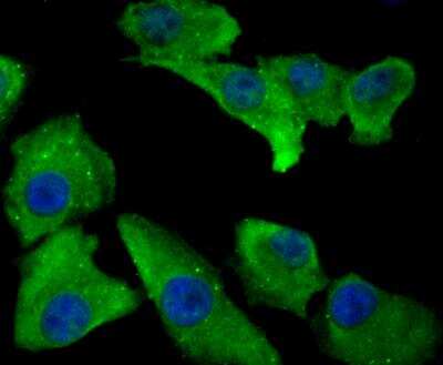 Immunocytochemistry/Immunofluorescence: Annexin A4 Antibody (JG37-83) [NBP2-76976] - ICC staining Annexin IV in A549 cells (green). The nuclear counter stain is DAPI (blue). Cells were fixed in paraformaldehyde, permeabilised with 0.25% Triton X100/PBS.