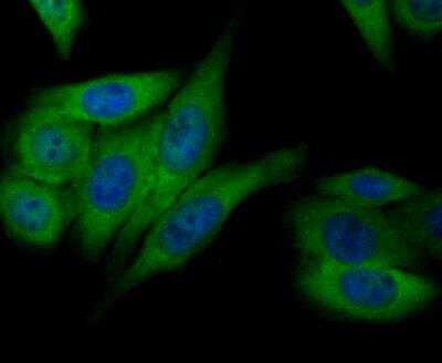 Immunocytochemistry/Immunofluorescence: Annexin A4 Antibody (JG37-83) [NBP2-76976] - ICC staining Annexin IV in HepG2 cells (green). The nuclear counter stain is DAPI (blue). Cells were fixed in paraformaldehyde, permeabilised with 0.25% Triton X100/PBS.