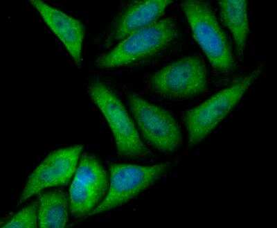 Immunocytochemistry/Immunofluorescence: Annexin A4 Antibody (JG37-83) [NBP2-76976] - ICC staining Annexin IV in SiHa cells (green). The nuclear counter stain is DAPI (blue). Cells were fixed in paraformaldehyde, permeabilised with 0.25% Triton X100/PBS.