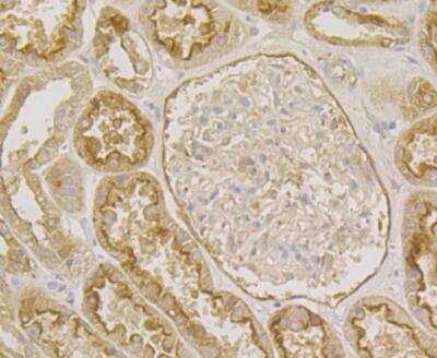 Immunohistochemistry: Annexin A4 Antibody (JG37-83) [NBP2-76976] - Immunohistochemical analysis of paraffin-embedded human kidney tissue using anti-Annexin IV antibody. Counter stained with hematoxylin.