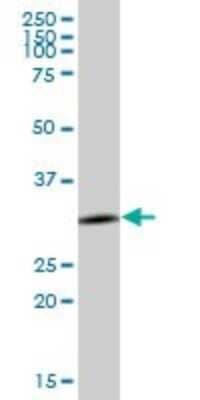 Western Blot: Annexin A4 Antibody [H00000307-B01P] - Analysis of ANXA4 expression in human stomach.