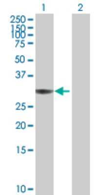Western Blot: Annexin A4 Antibody [H00000307-B01P] - Analysis of ANXA4 expression in transfected 293T cell line by ANXA4 polyclonal antibody.  Lane 1: ANXA4 transfected lysate(35.31 KDa). Lane 2: Non-transfected lysate.