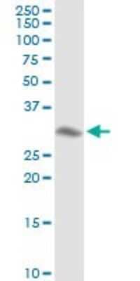 Western Blot: Annexin A4 Antibody [H00000307-D01P] - Analysis of ANXA4 expression in A-431.