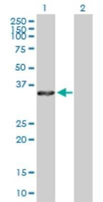 Western Blot: Annexin A4 Antibody [H00000307-D01P] - Analysis of ANXA4 expression in transfected 293T cell line by ANXA4 polyclonal antibody.Lane 1: ANXA4 transfected lysate(36.10 KDa).Lane 2: Non-transfected lysate.