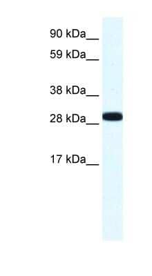 Western Blot: Annexin A4 Antibody [NBP1-59120] - Titration: 1.25ug/ml, Positive Control: Human Placenta.