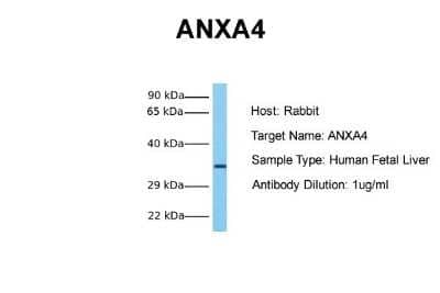 Western Blot: Annexin A4 Antibody [NBP1-59120] - Sample Tissue: Human Fetal Liver Antibody Dilution: 1.0 ug/ml