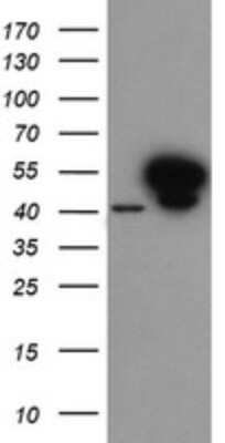 Western Blot: Annexin A7 Antibody (1C3) [NBP2-45494] - Analysis of HEK293T cells were transfected with the pCMV6-ENTRY control (Left lane) or pCMV6-ENTRY Annexin A7.