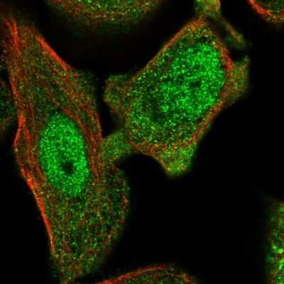 Immunocytochemistry/Immunofluorescence: Annexin A7 Antibody [NBP2-57620] - Staining of human cell line PC-3 shows localization to nucleoplasm & cytosol.