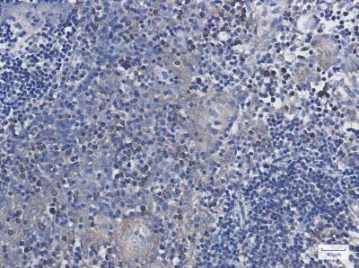 Immunohistochemistry-Paraffin: Annexin A7 Antibody (S07-1D2) [NBP3-19944] - Immunohistochemistry of Annexin A7 in paraffin-embedded Human tonsil using NBP3-19944 at dilution 1/50